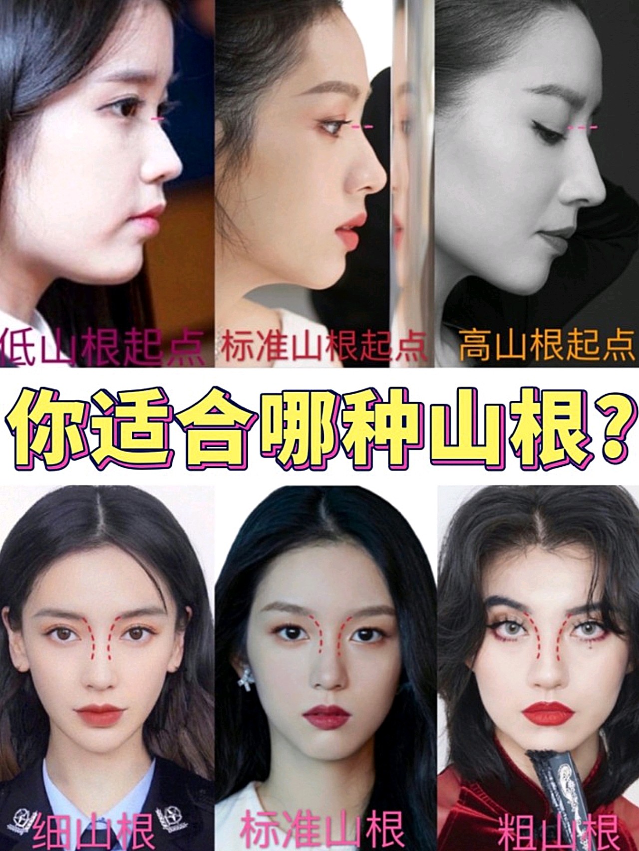 9199鼻审美必懂|你适合什么样的山根9571-鼻山根是否_圈子