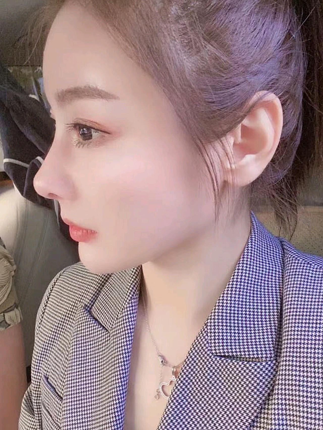 感谢宫医生的鬼斧神工赐我一个妈生鼻.