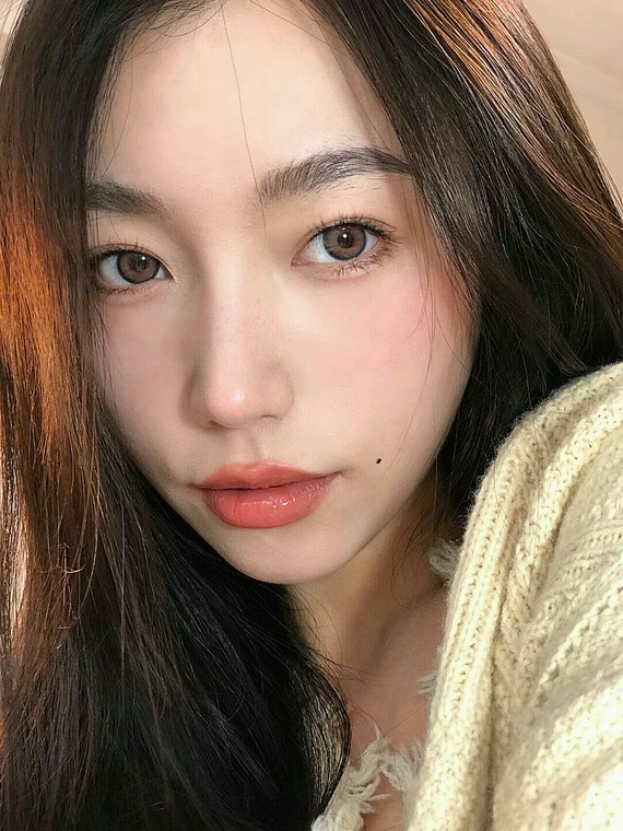 脸部的脂肪和额头的脂肪吸收的挺好的,额头也很饱满,_圈子-新氧美容