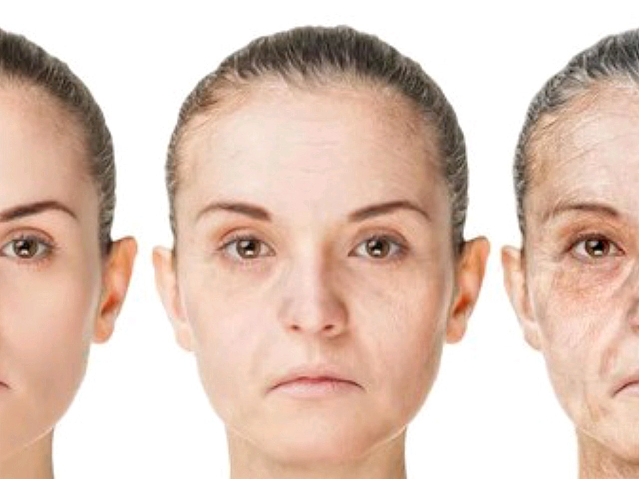 热玛吉和热拉提哪个更适合你