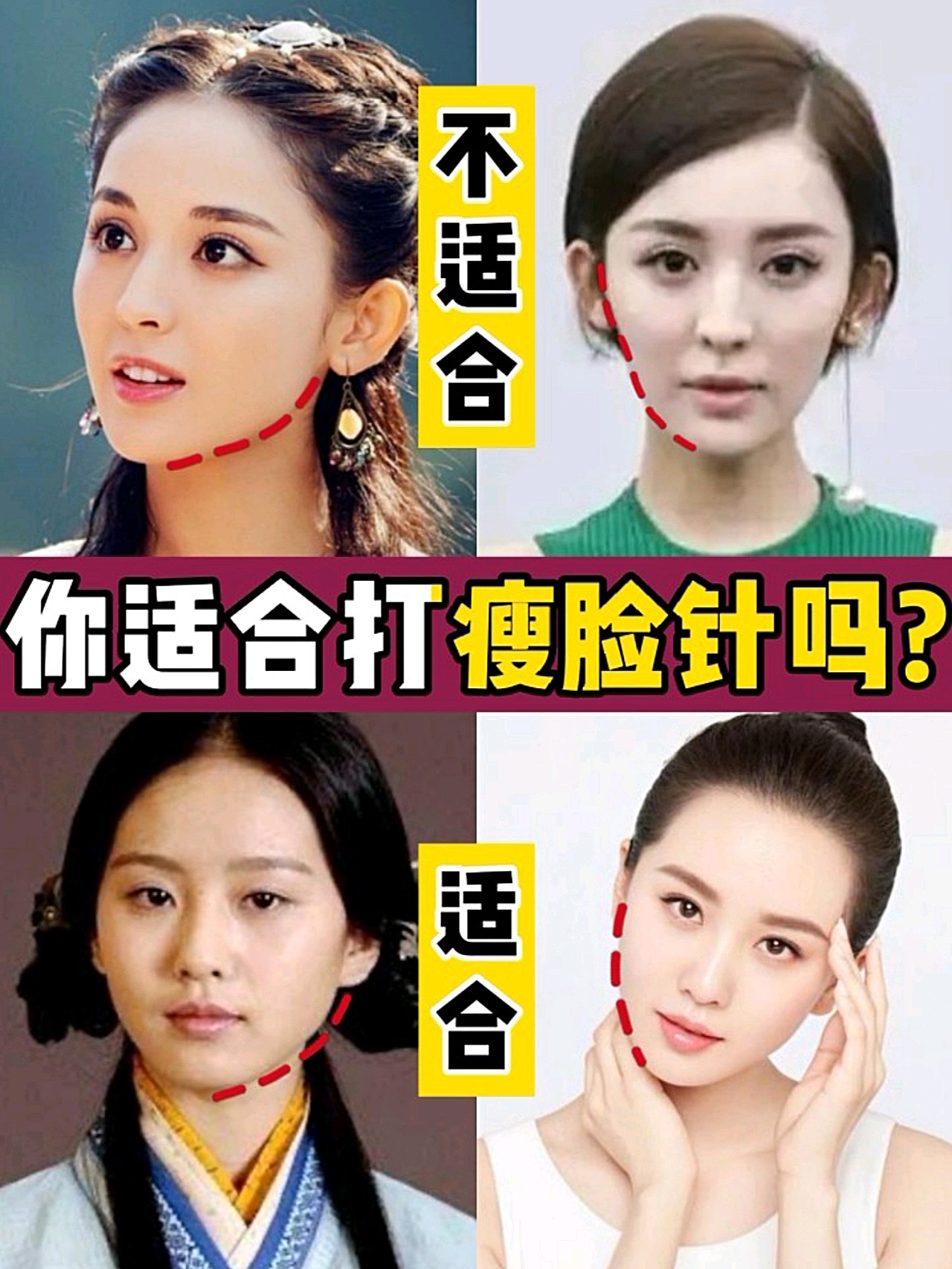 这几类人9369♀15不适合打瘦脸针746015.
