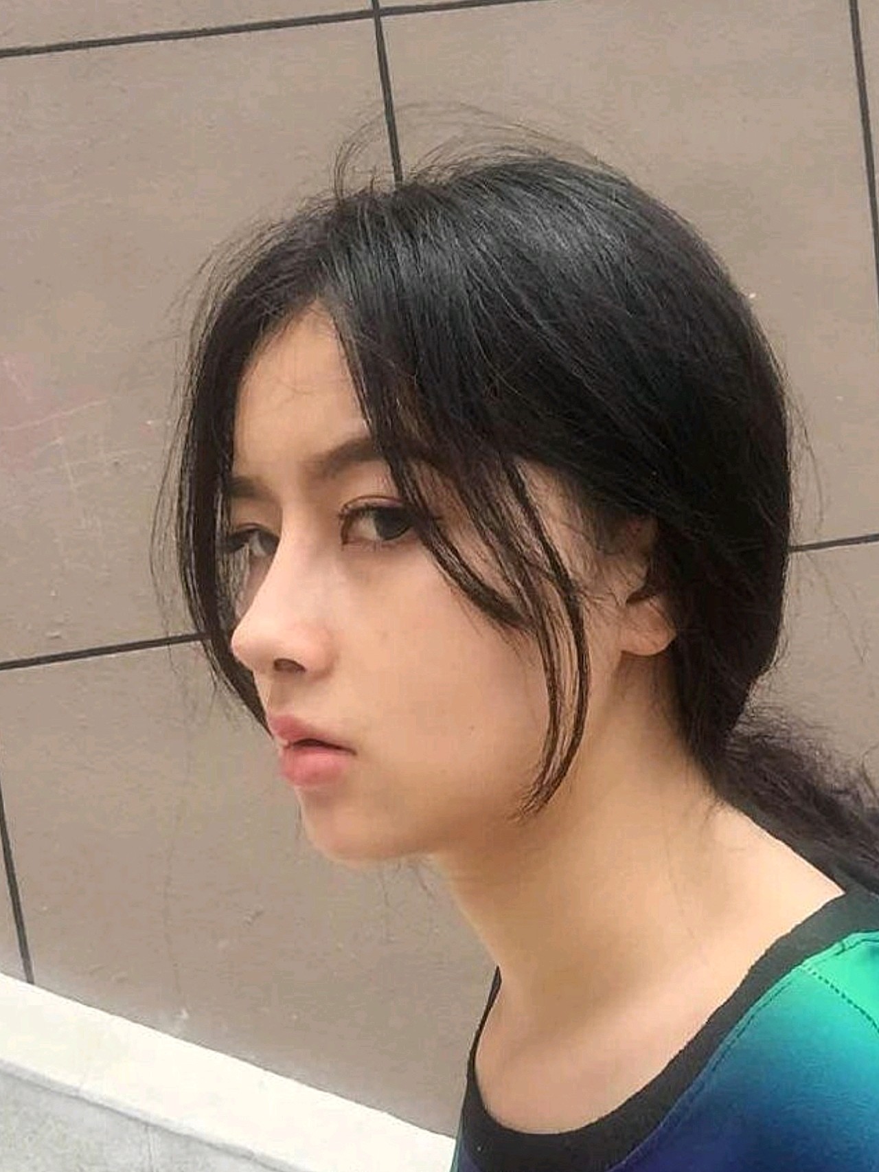 看惯了那些网红鼻子,还是想要一个比较自然的,跟林勇_圈子-新氧美容