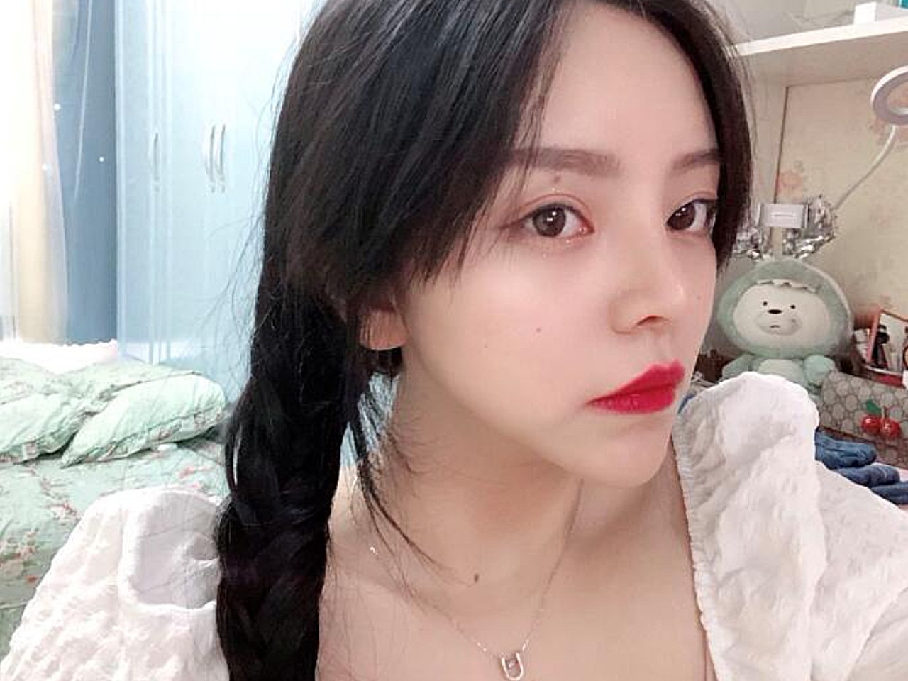 术前诊断鼻小柱过短,侧面看上去鼻子很短鼻梁塌,鼻翼_圈子-新氧美容
