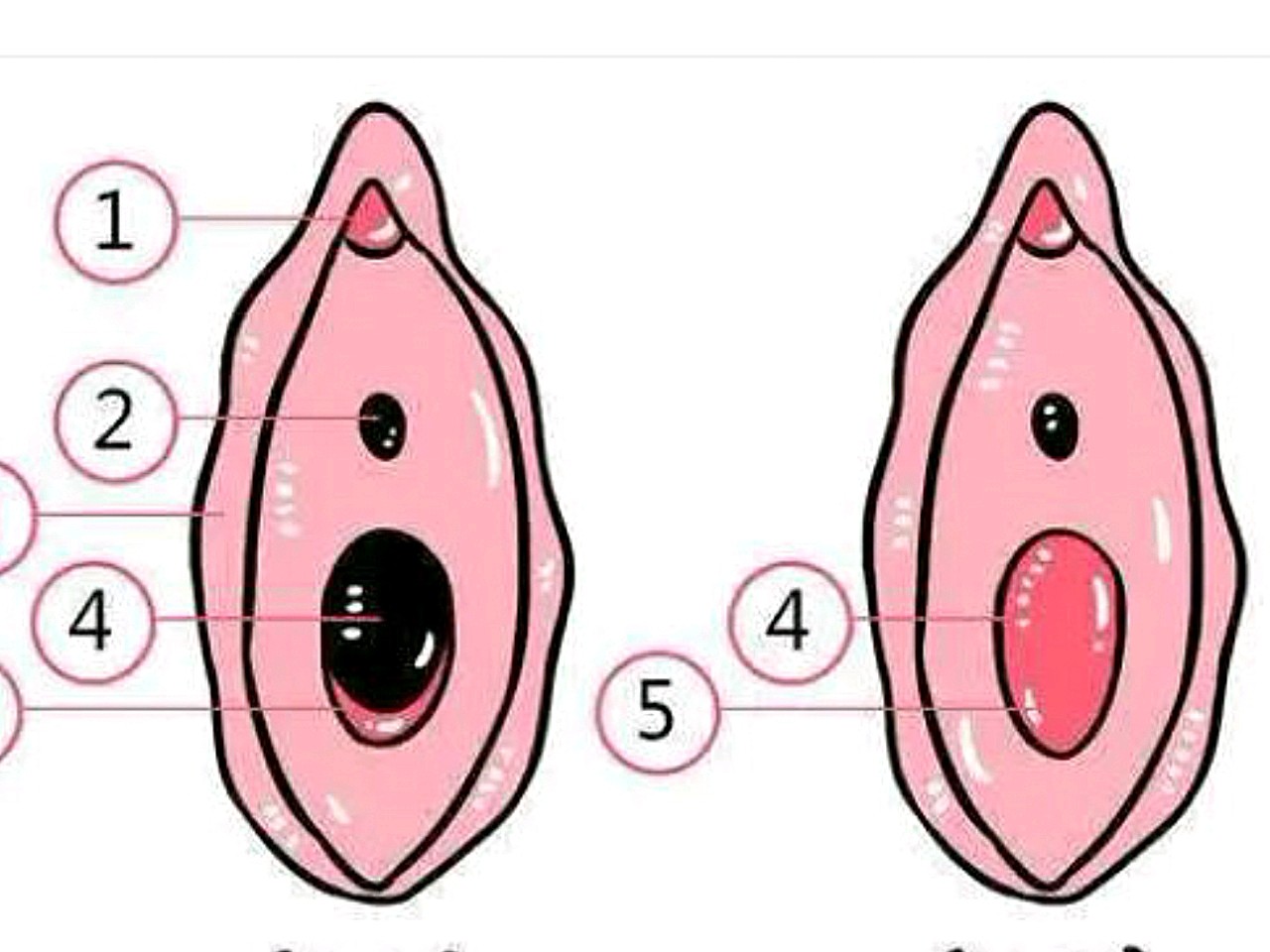 处女膜修复手术并不会影响女性生育处女膜修复手术并不_圈子-新氧美容