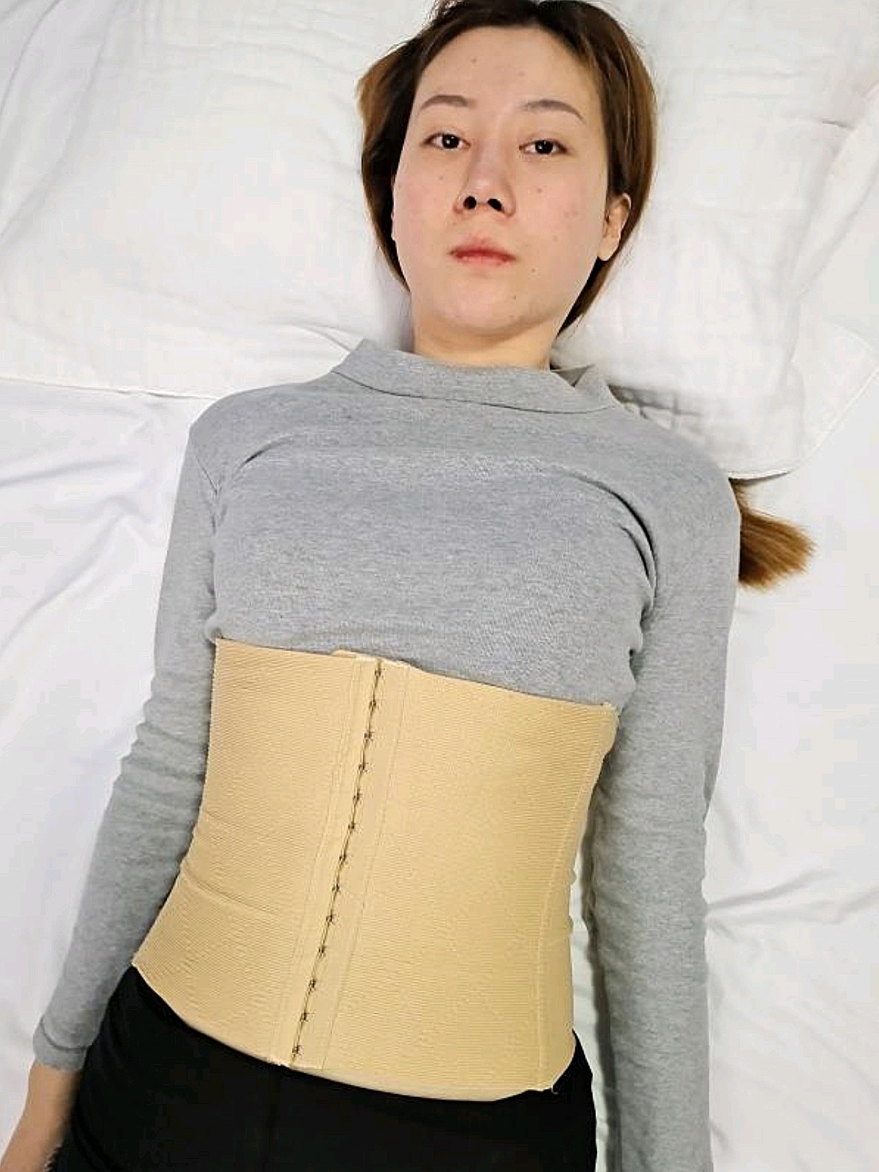 腰腹环吸恢复过程图图片