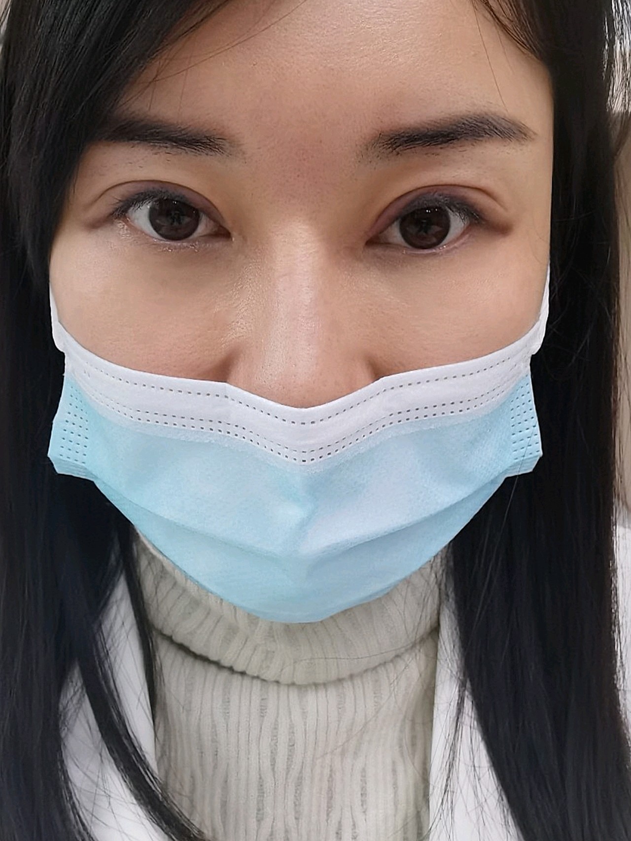 激光洗眼线疼痛感太强了06不过效果还是不错的期待七天_圈子-新氧