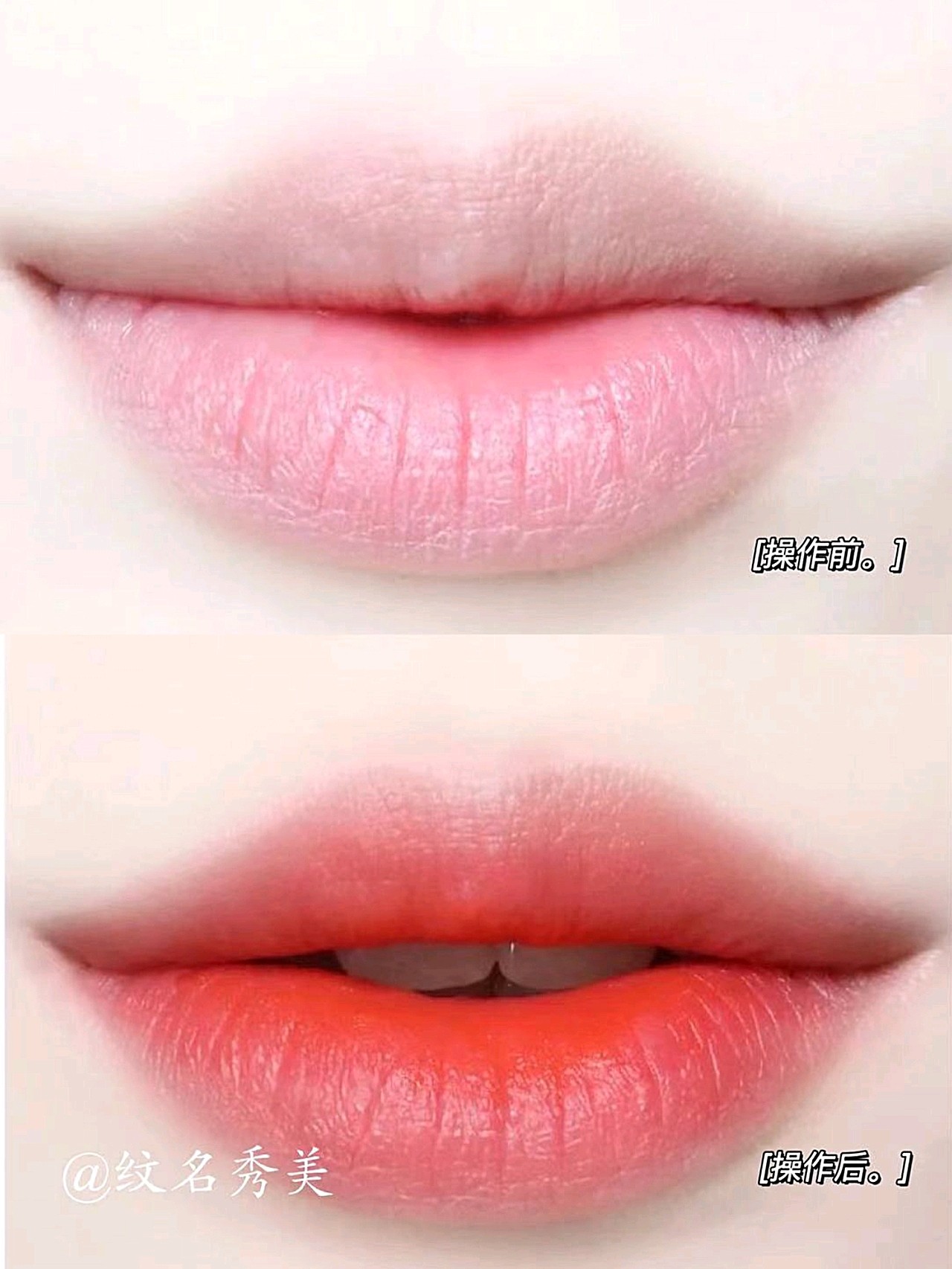 纹唇恢复过程修复效果太自然好看了大家还停留在以前