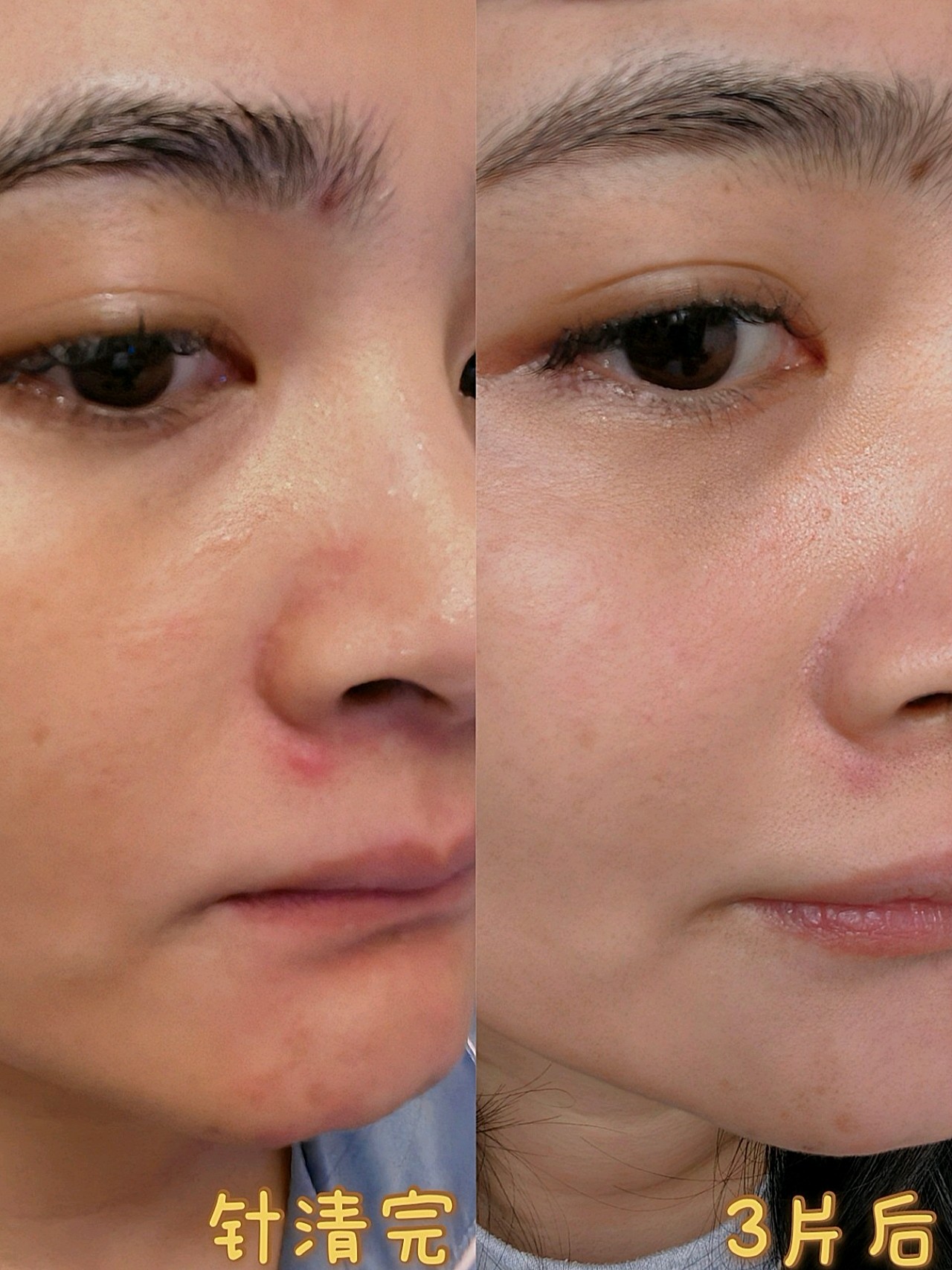 新氧体验官赛洛丝汀王炸修复套