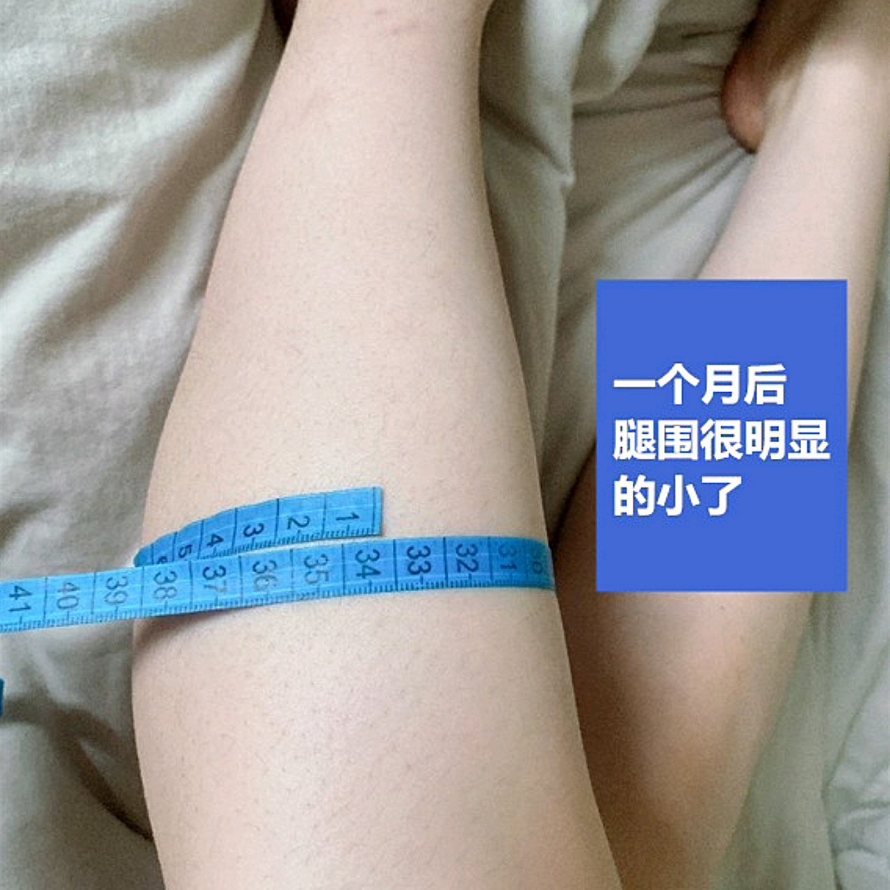 体验项目瘦腿针