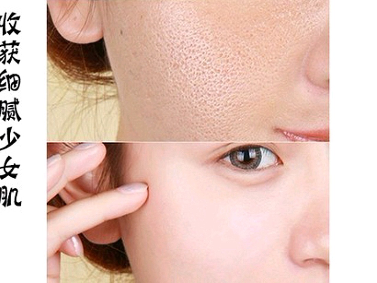 光子嫩肤收缩毛孔效果怎么样?