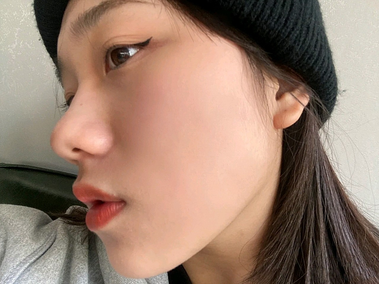 下颌线清晰了,侧面看着都更加精致秀气,体验过程比较_圈子-新氧美容