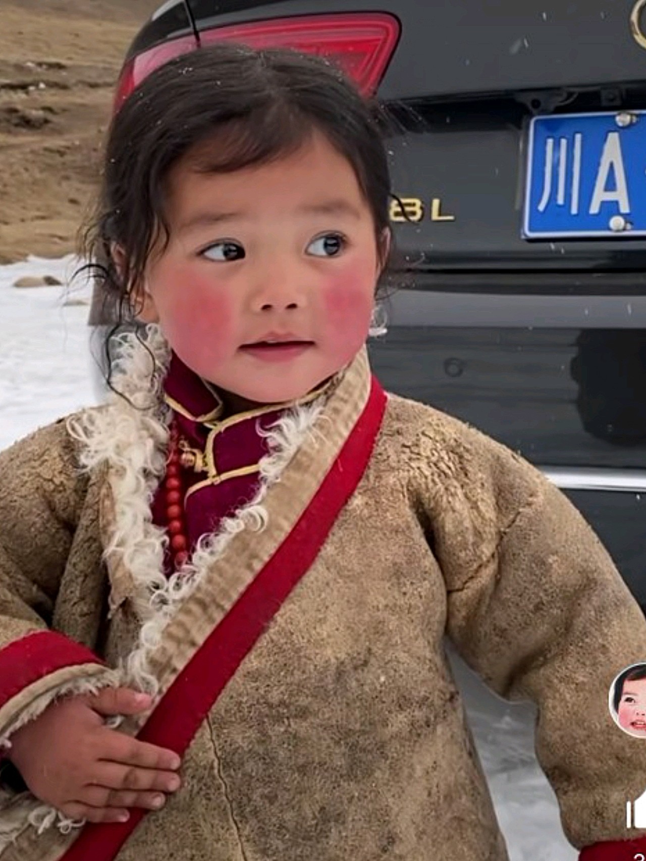 清澈的双眸,纯真的笑脸,雪花绽放在高原红的脸蛋上,_圈子-新氧美容