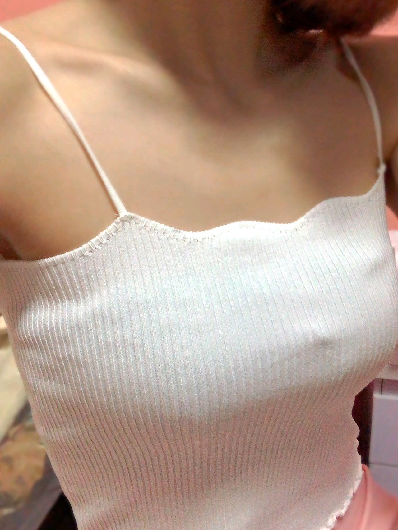 做完假体隆胸,胸部用纱布和绷带包着,当时带着止痛泵_圈子-新氧美容