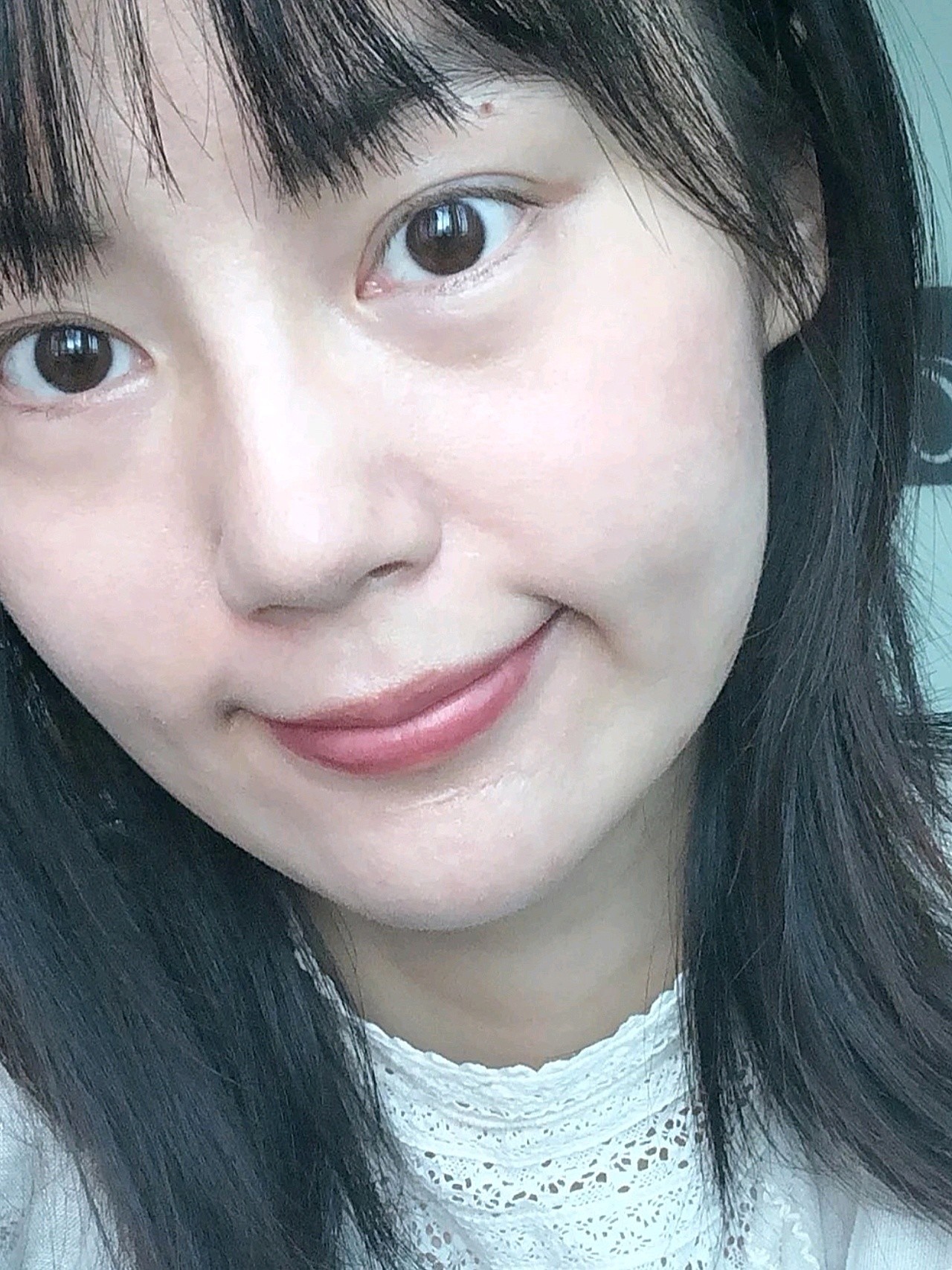 当天是素颜过来的,皮肤状态确实不好,脸部问题一目了_圈子-新氧美容
