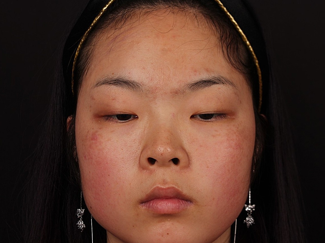 凤尾眼,可能在别人脸上好看,但是肥胖的人真的不适合_圈子-新氧美容