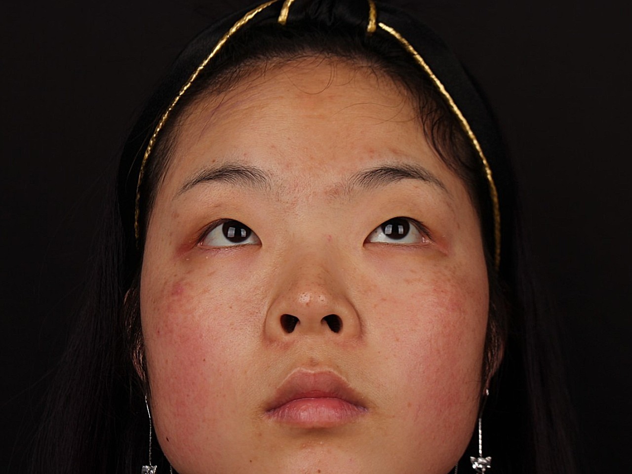 凤尾眼,可能在别人脸上好看,但是肥胖的人真的不适合_圈子-新氧美容