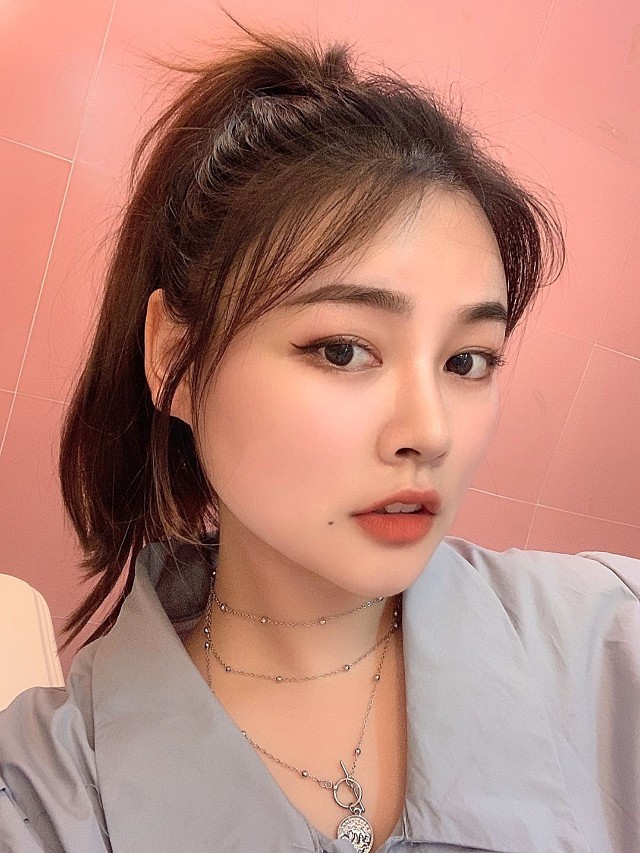 我术前额头比较平,苹果肌处也很平,这跟我的少女心一_圈子-新氧美容