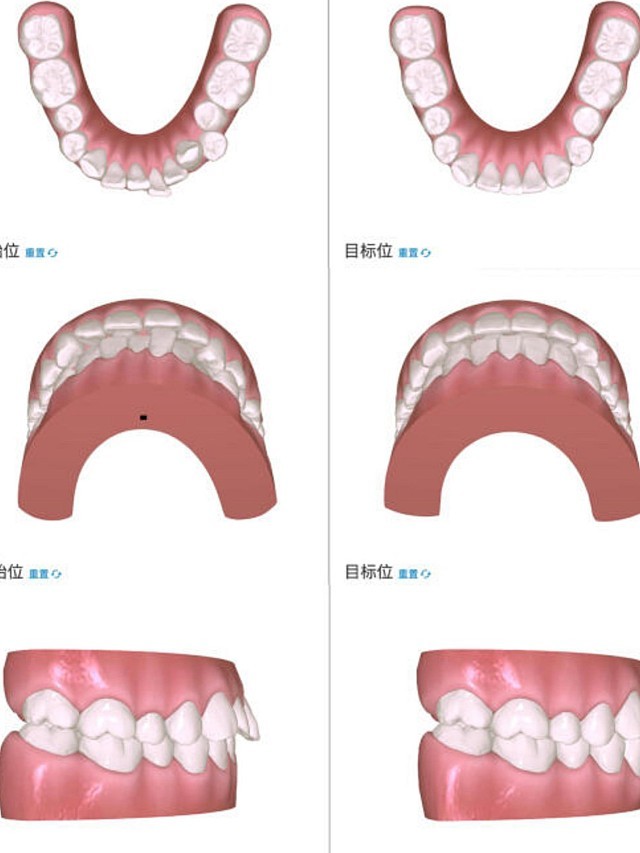 谁说成人不能整牙我也要八颗牙的微笑