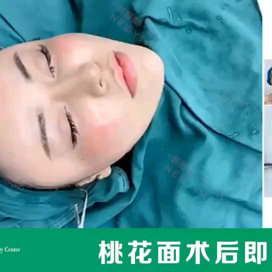【新颐美&桃花面案例】 面部要轮廓分明💫