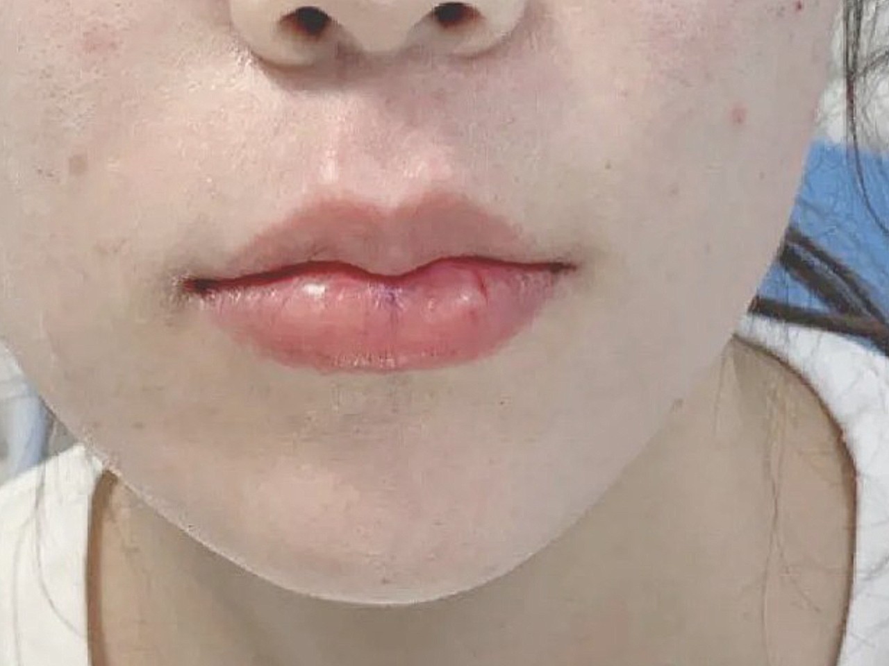 我的嘴唇挺干瘪的,唇形也不怎么好看,我很喜欢韩国那_圈子-新氧美容