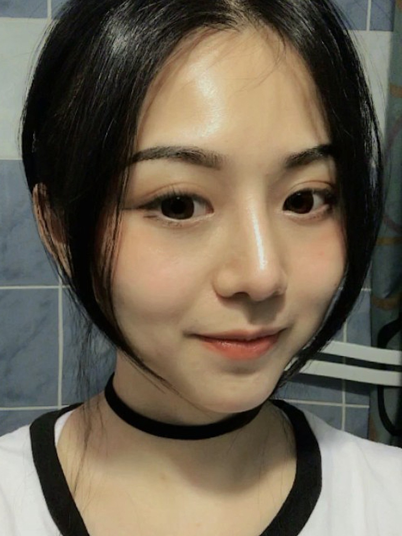 妈生鼻-自然鼻部多项案例分享术前诊断96求美者诉求:求_圈子-新氧