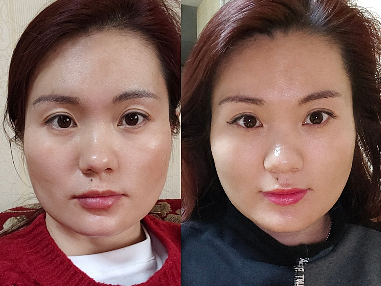 免注射费 紧致提升 轮廓精塑