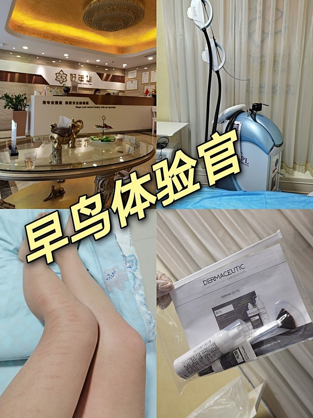 冰点脱毛鸡皮肤(冰点脱毛鸡皮肤多久能好)