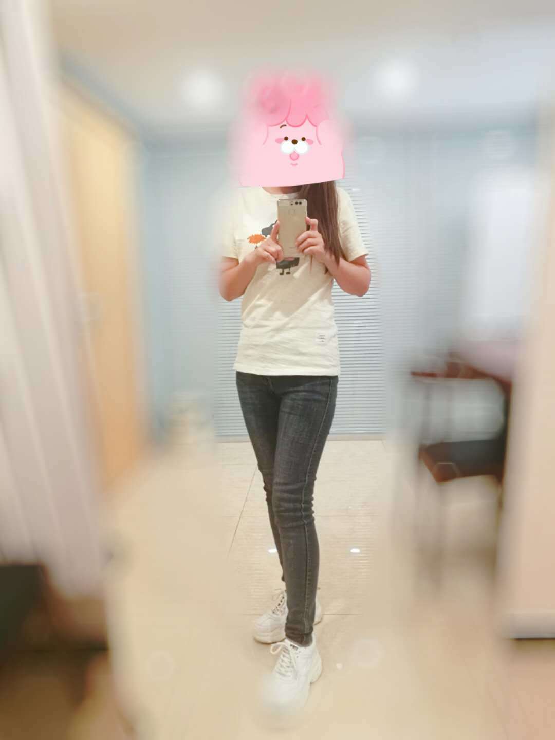 大腿吸脂主要是为了改善腿型,身高162,体重104_圈子-新氧美容整形