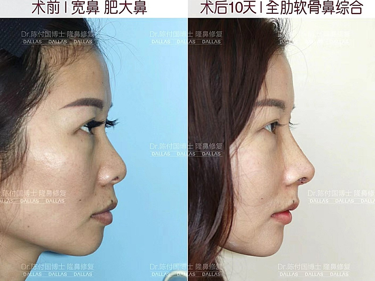 术前小患者基础是以"宽"为主要特色的短