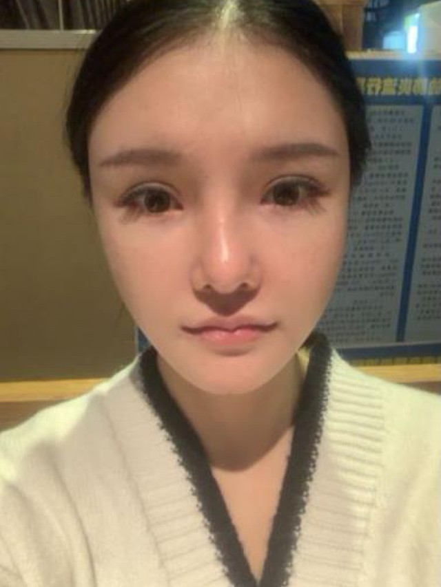 我以前正面看不到脸 小朋友嘲笑没有耳朵 我慕名来到 圈子 新氧美容整形