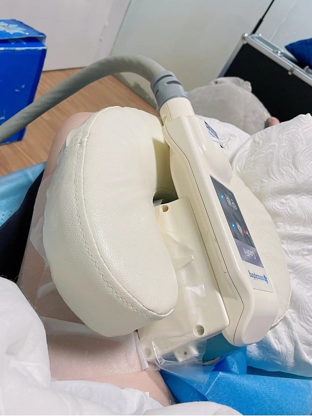 今天来做个酷塑冷冻溶脂疼是能接受的就是做完