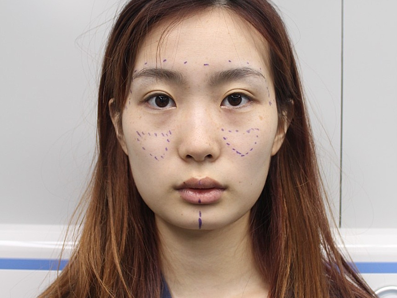 潮流审美变迁,萌萌哒的饱满心形脸已经取代了畸形审美的锥子脸,成为