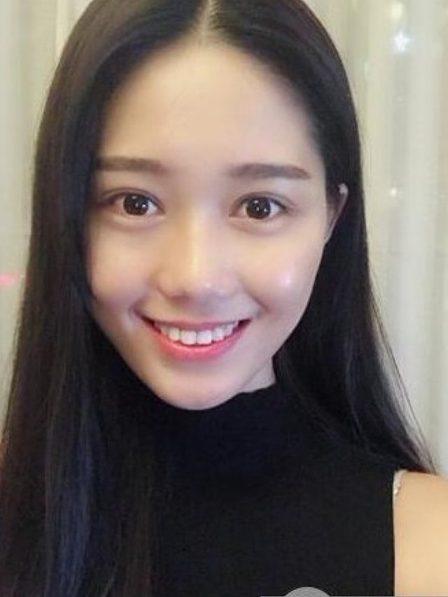 身边朋友都说,我割了双眼皮,变知性了不少,特别温婉_圈子-新氧美容