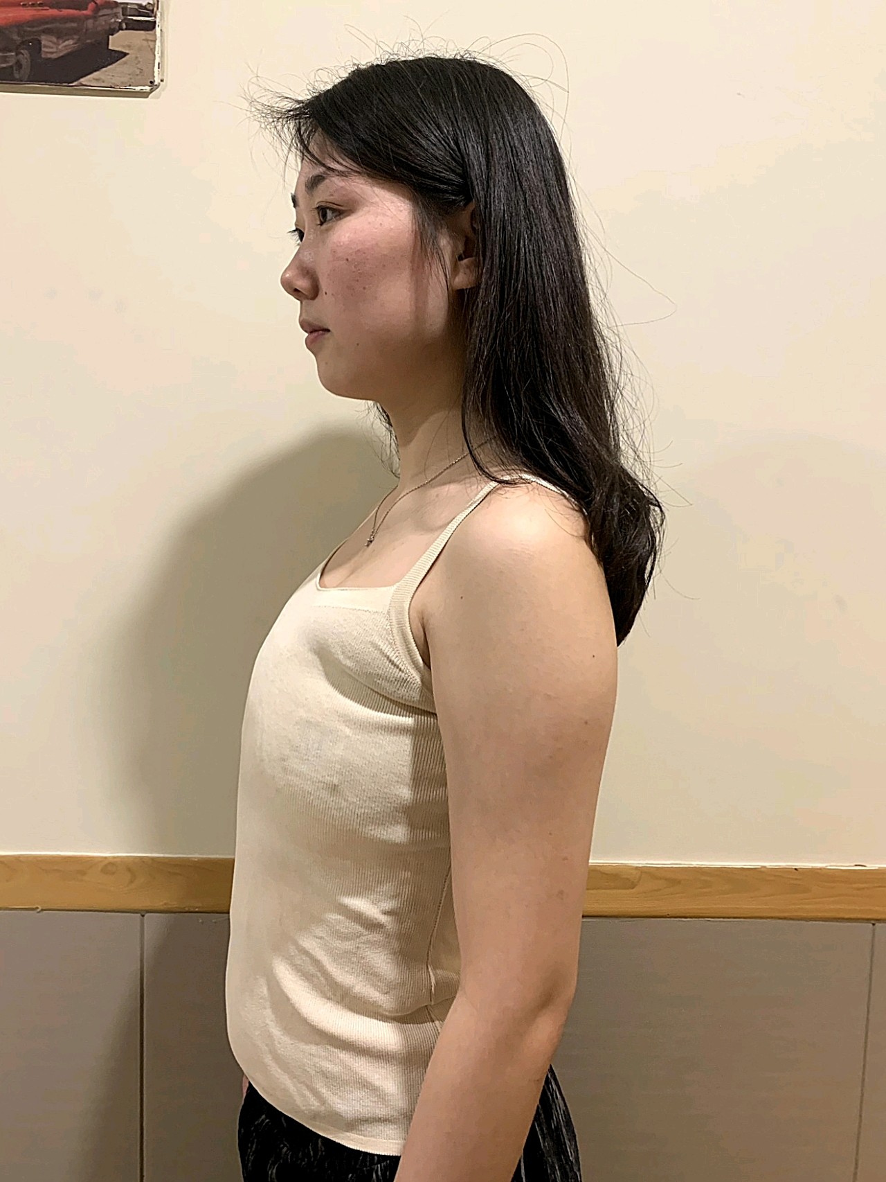 内窥镜技术 蓝贝假体丰胸元素手感形态丰满自然 不影响哺乳