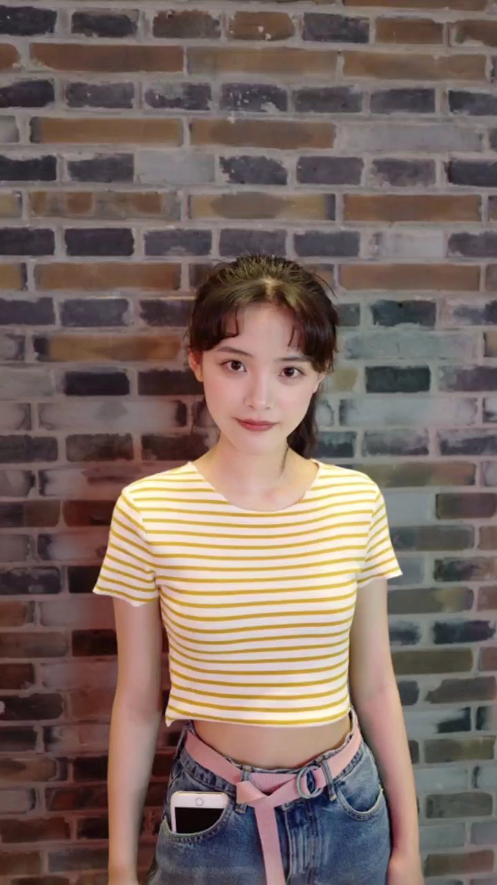 郭唯医生的双眼皮手术过程,上眼睑画了一个线,然后顺_圈子-新氧美容