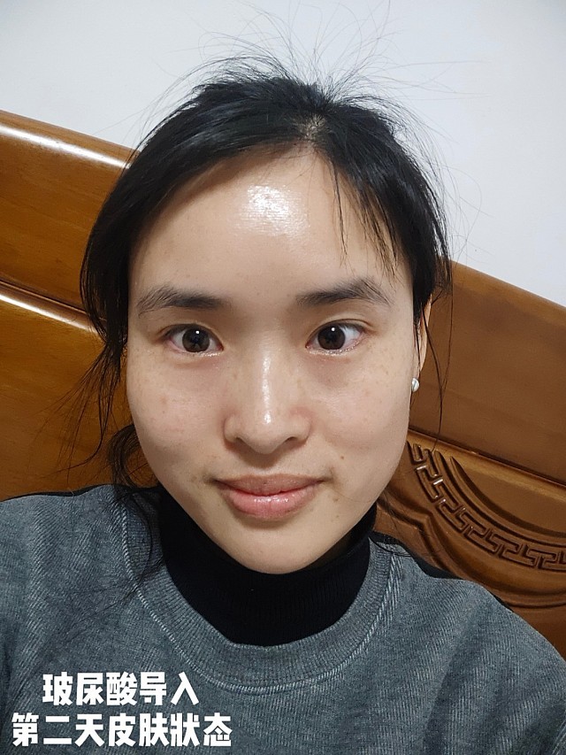 作为一个干性皮肤的人,每到换季的时候,空气干燥,皮肤锁水能力下降