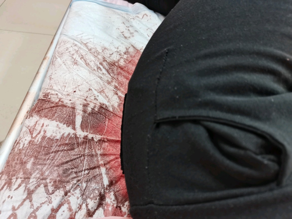 不知道我会不会是第一个大姨妈流血流死的,早上9点多_圈子-新氧美容