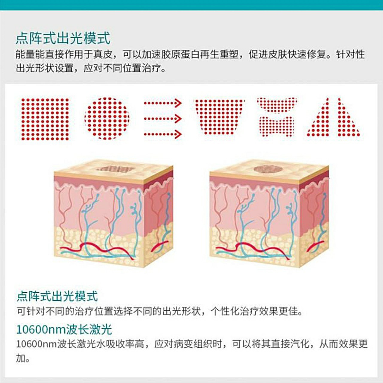 点阵激光原理图片