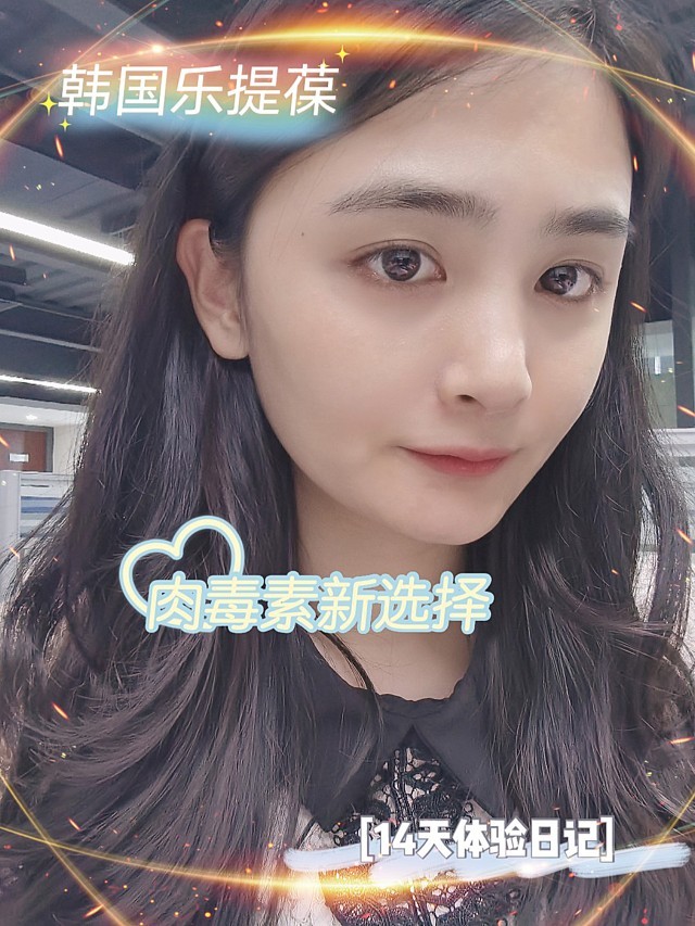 【除皱瘦脸】 进口 100单位 【韩国进口紧致针40u】韩国医生注射,塑造