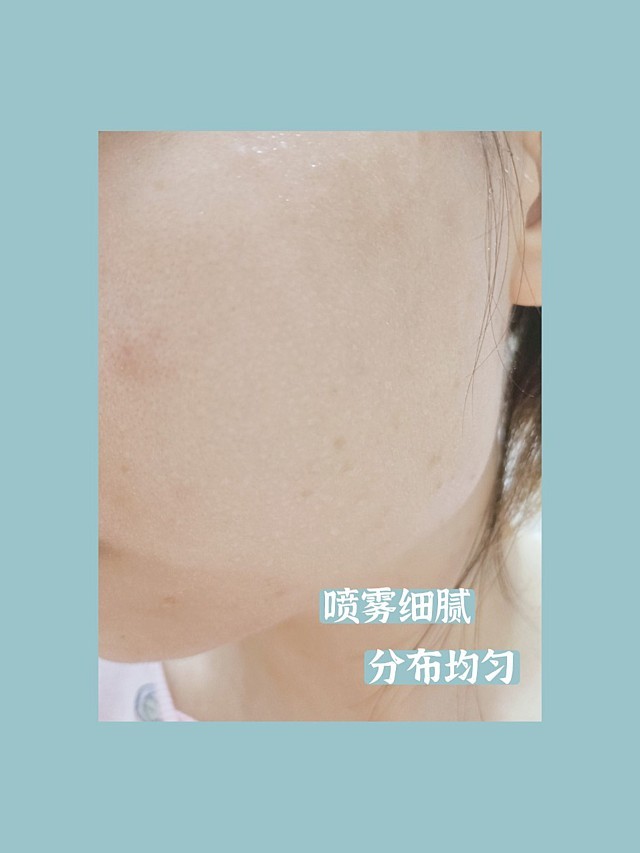 法国美帕百万喷雾公益救助活动第5季