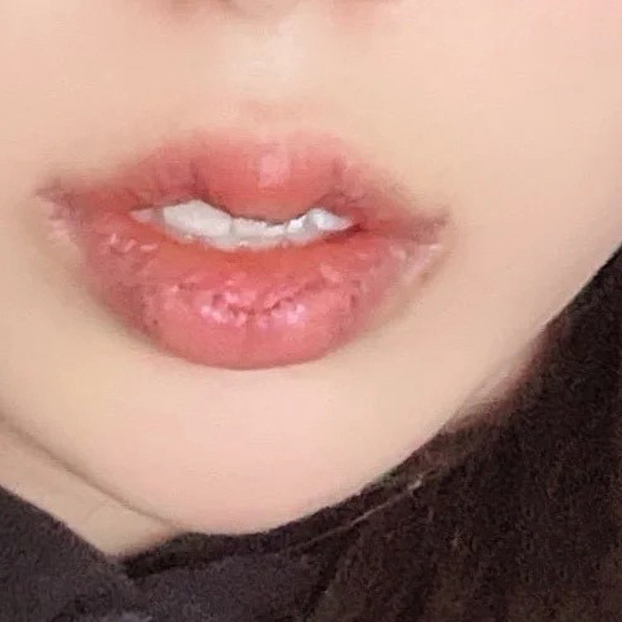 做了m唇和花瓣唇,效果倒是出来了,感觉还不错咯,谢_圈子-新氧美容整形