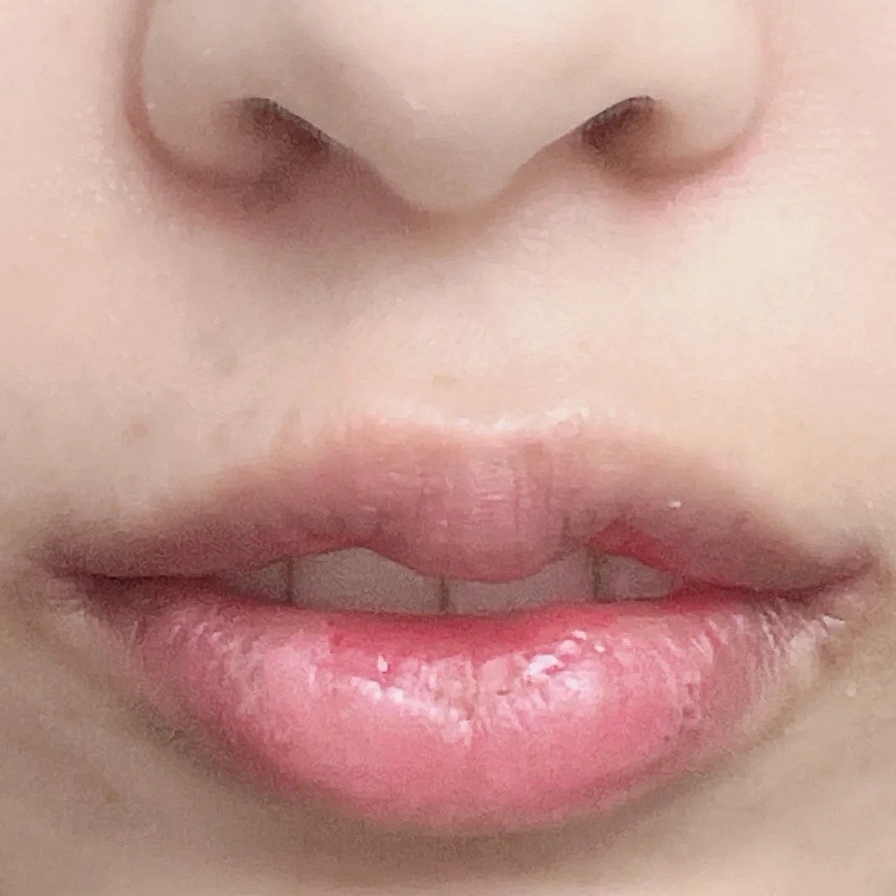 做了m唇和花瓣唇,效果倒是出来了,感觉还不错咯,谢_圈子-新氧美容整形