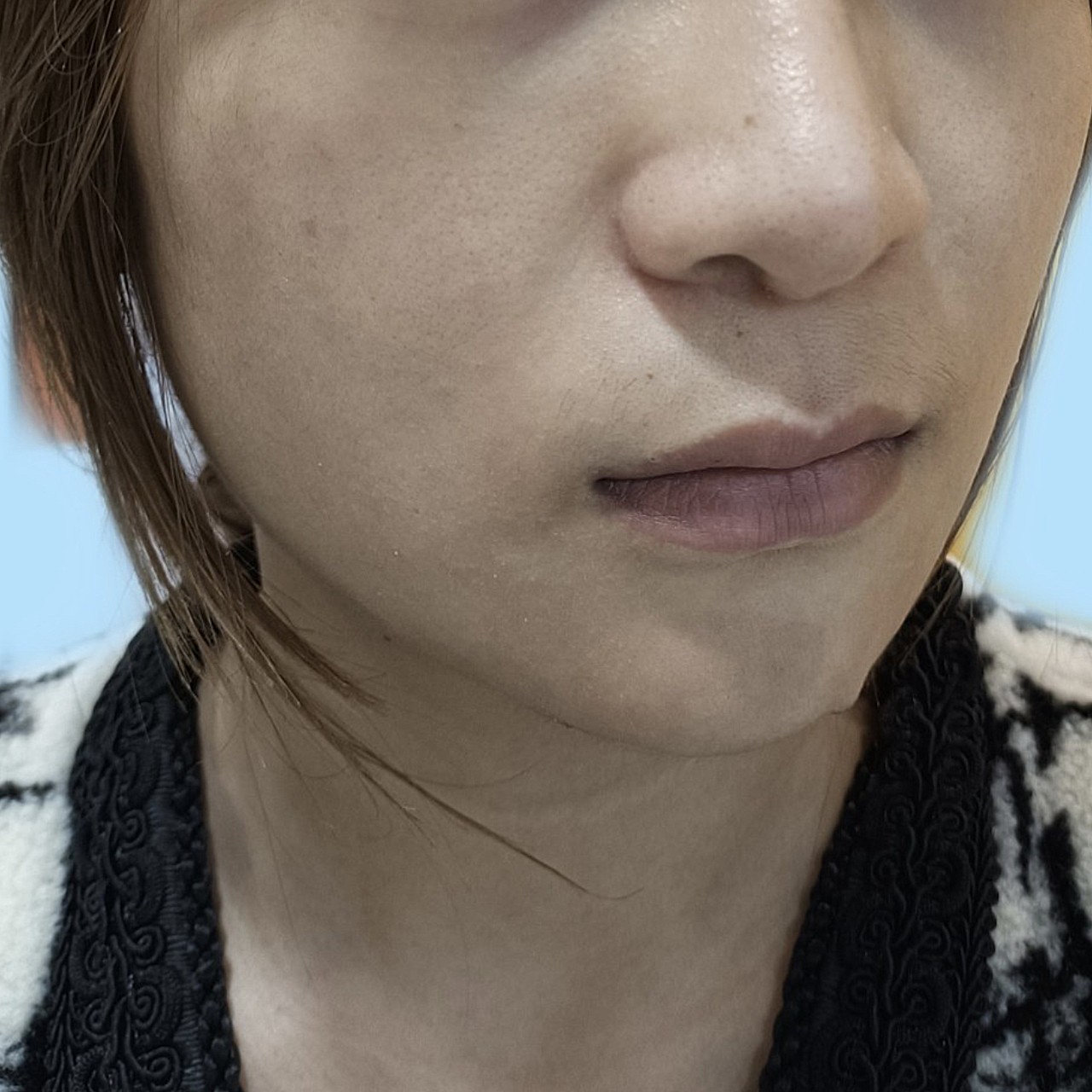 我人中偏长,嘴唇也没有形状,看起来就有一点瘪嘴,显老,还有一