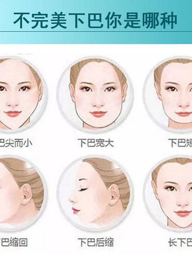 假体隆丰下巴是改变脸型一个非常有用的方法,很多人都_圈子-新氧美容