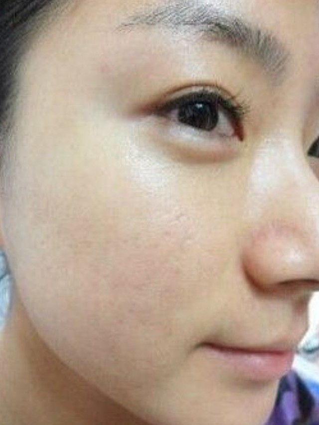 体验前变美诉求:肤色暗沉斑点 皮肤敏感泛红 红血