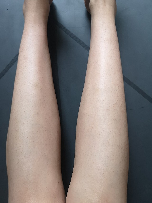 鸡皮肤光滑了怎么办(鸡皮肤光滑了怎么办图片) 鸡皮肤光滑了怎么办(鸡皮肤光滑了怎么办图片)