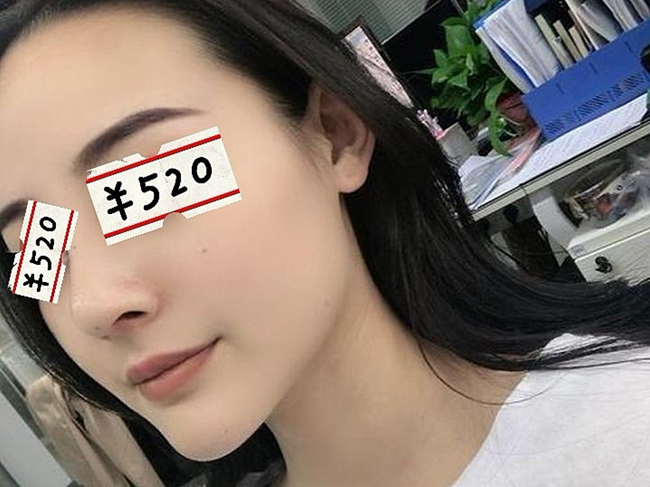 我的原生鼻子鼻背低,没有山根,鼻头圆顿还有鼻基底凹_圈子-新氧美容