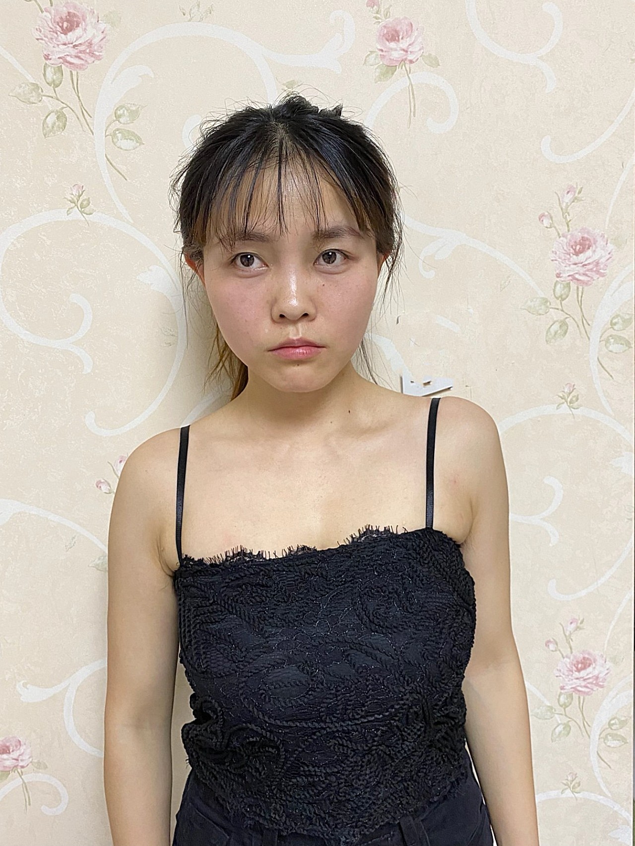 求美者胸部很平,先天发育不是很乐观,胸部明显有下垂_圈子-新氧美容