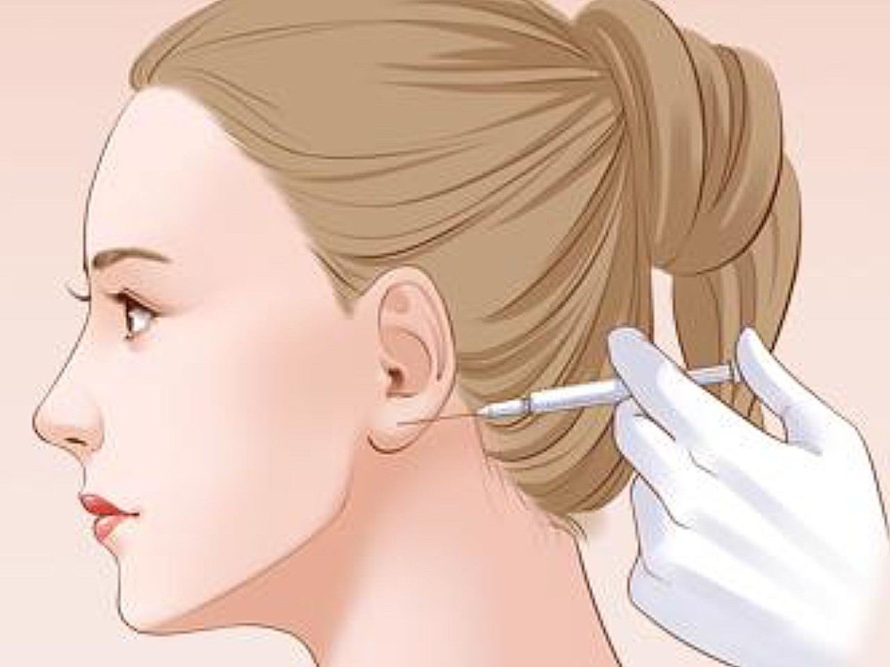 瘦脸针其实就是a型肉毒素针剂,对咬肌肥大造成的脸大_圈子-新氧美容