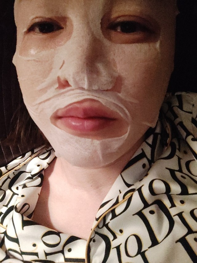 婕尔玻尿酸丰唇后续感受和效果.